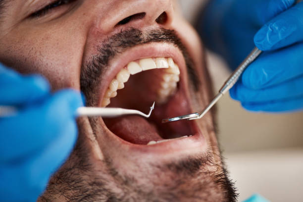 Best Emergency Gum Pain Relief  in Oswego, IL